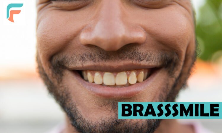 BrassSmile
